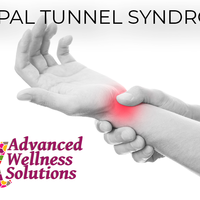 Carpal Tunnel Syndrome Treatment
