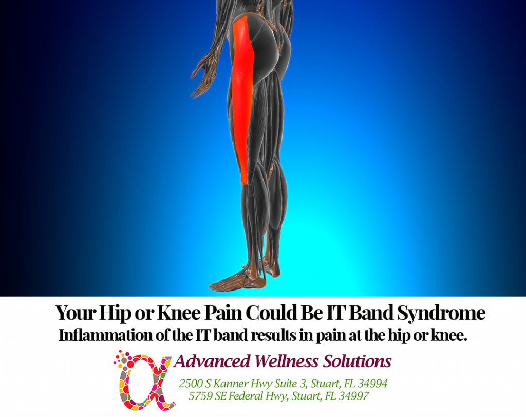 Your Hip or Knee Pain Could Be IT Band Syndrome Inflammation of the IT band results in pain at the hip or knee.