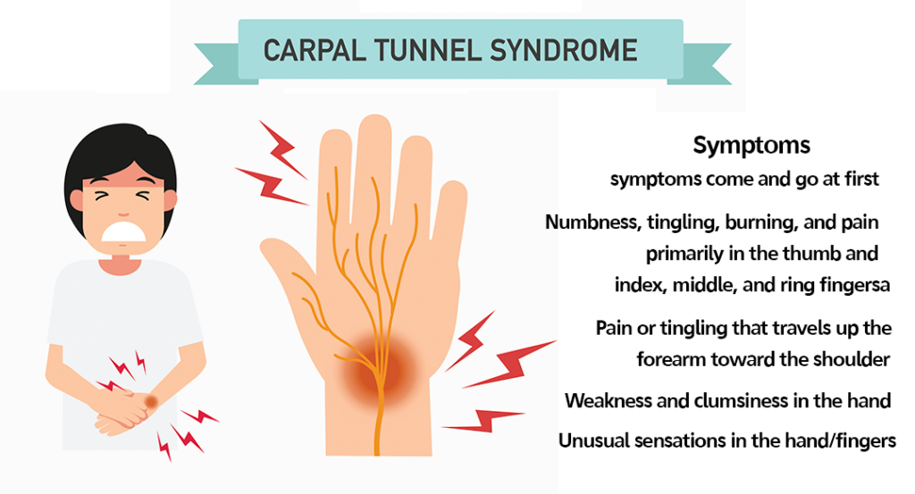 Carpal Tunnel Syndrome: Symptoms come and go at first. Numbness, tingling, burning and pain primarily in the thumb and index, middle and ring fingers.