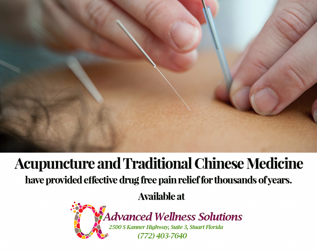 Acupuncture and Chinese Medicine 