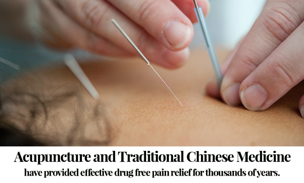 Acupuncture and Chinese Medicine