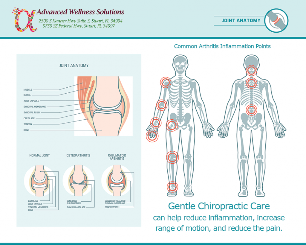 gentle chiropractic care for arthritis pain management