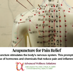 Acupuncture for Pain