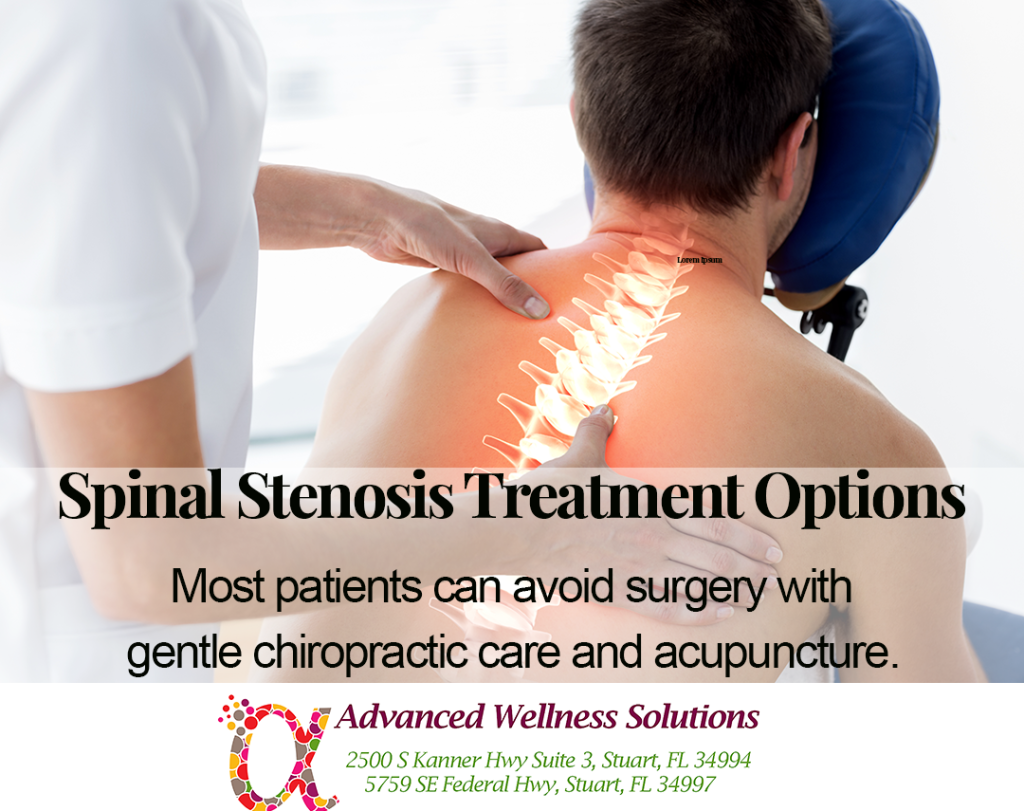Spinal Stenosis Treatment Options: Most patients can avoid surgery by using gentle chiropractic therapy and acupuncture.